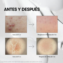Cargar imagen en el visor de la galería, VT COSMETICS VT REEDLE SHOT 300, Advanced Night Exosome, suero de microagujas, 50 ml
